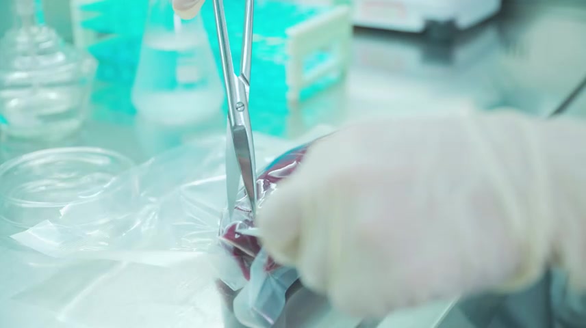 肉类加工厂肉类检验牛肉检验.