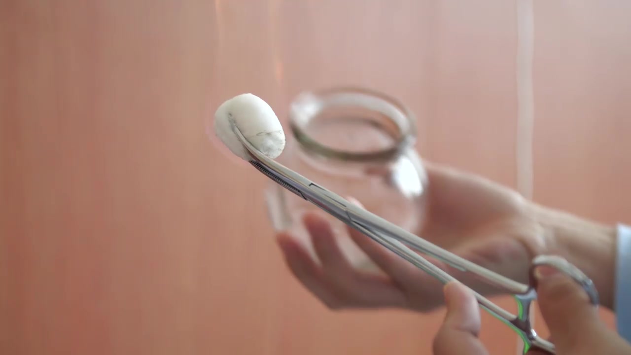 中医 实拍拔罐火罐中医理疗特写高清背景视频