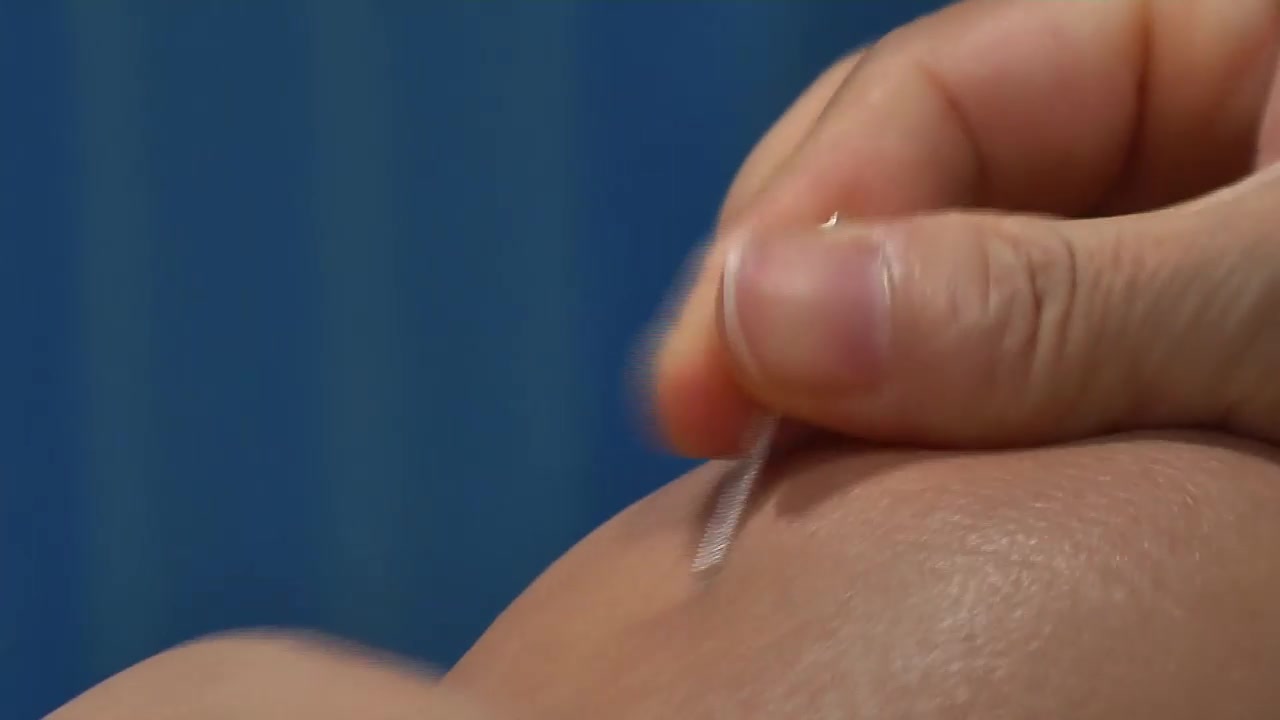 中医 中医针灸实拍视频望闻问切